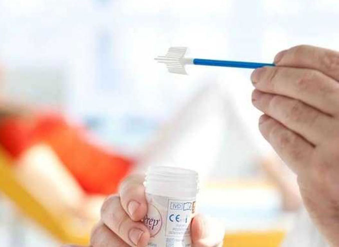 smear pap testi